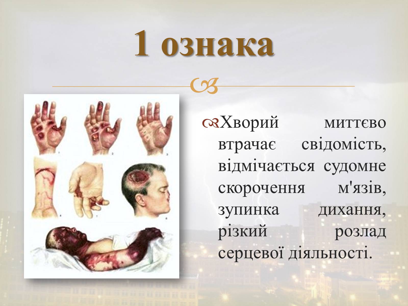 Презентація на тему «Електротравма» - Слайд #4 Презентація на тему «Електротравма» - Слайд #4