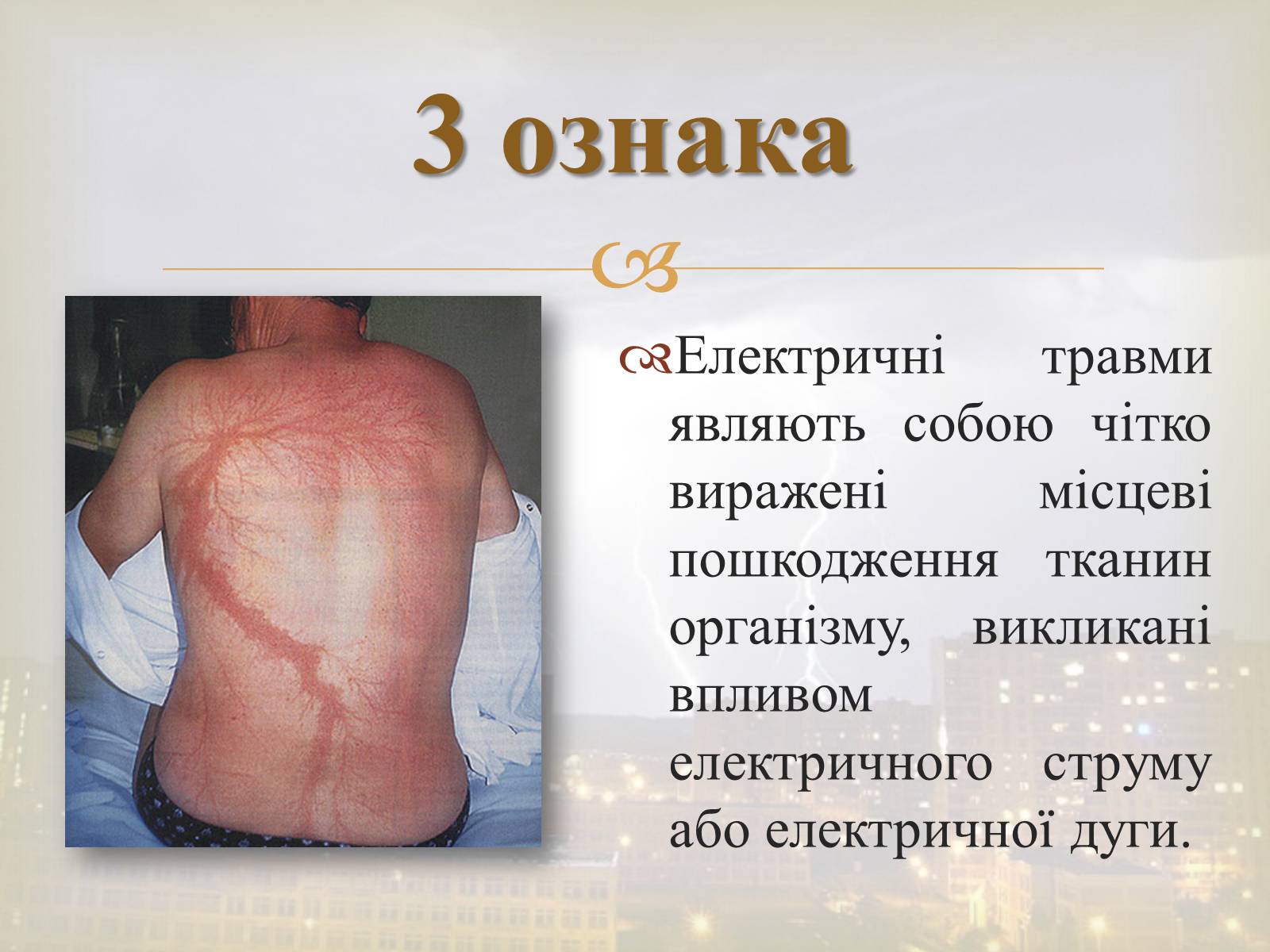 Презентація на тему «Електротравма» - Слайд #6 Презентація на тему «Електротравма» - Слайд #6
