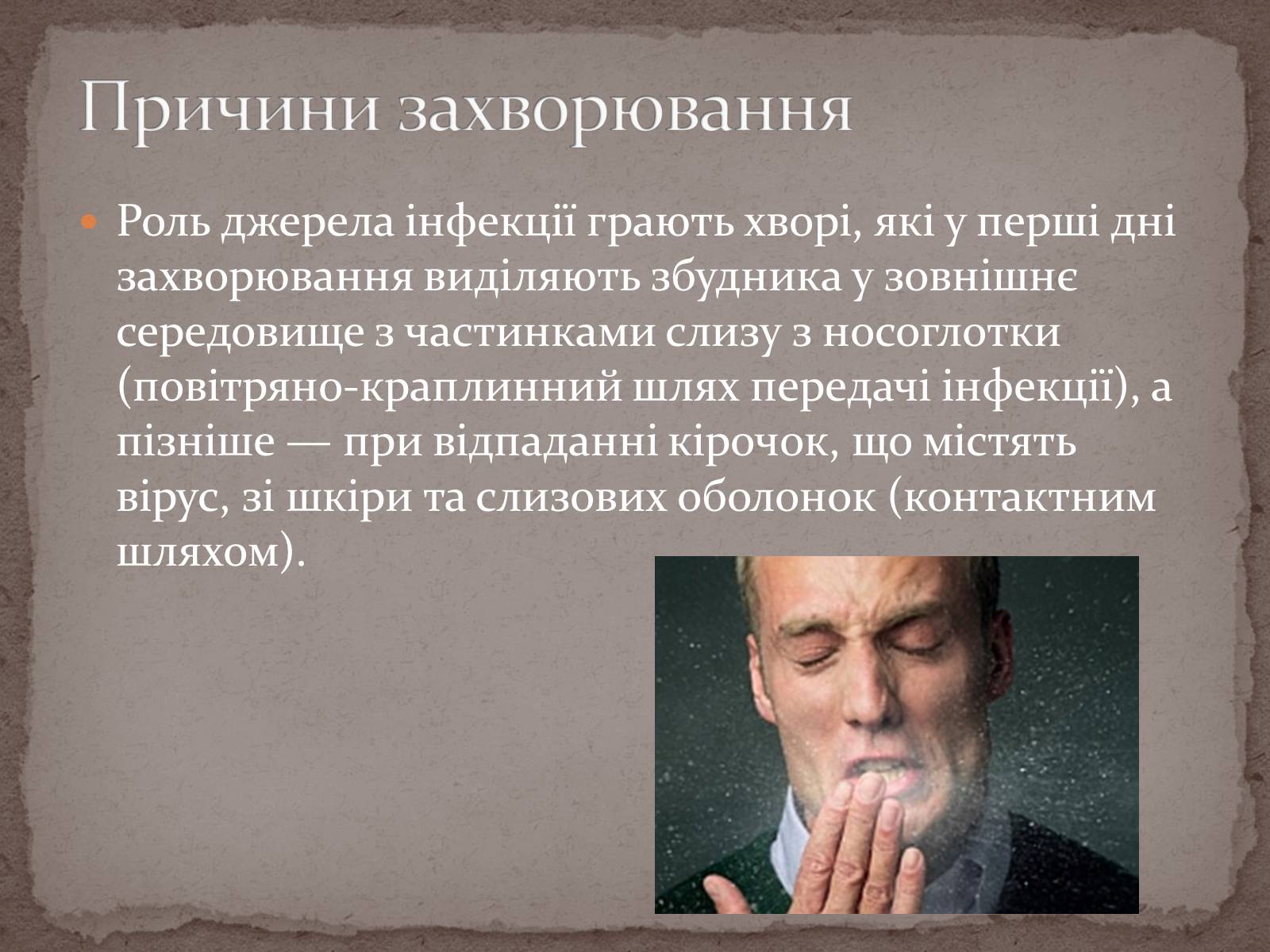 Презентація на тему «Натуральна віспа» - Слайд #8 Презентація на тему «Натуральна віспа» - Слайд #8