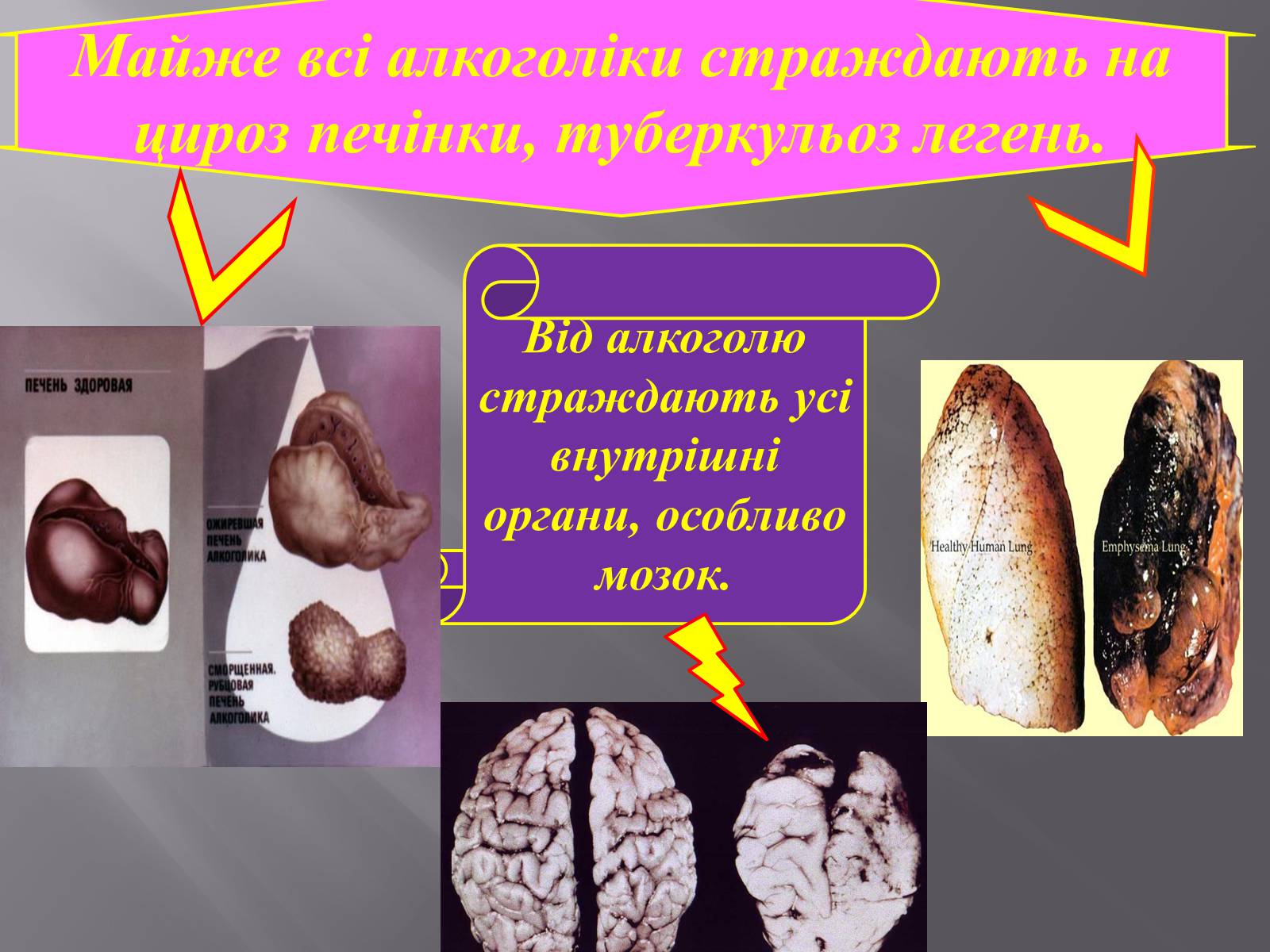 Презентація на тему «Вплив куріння, алкоголю на репродуктивне здоров’я» - Слайд #13 Презентація на тему «Вплив куріння, алкоголю на репродуктивне здоров’я» - Слайд #13