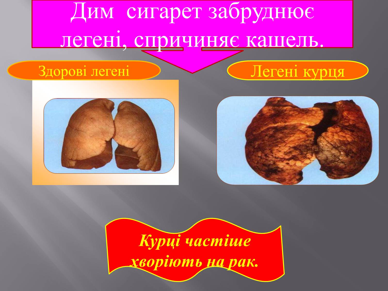 Презентація на тему «Вплив куріння, алкоголю на репродуктивне здоров’я» - Слайд #5 Презентація на тему «Вплив куріння, алкоголю на репродуктивне здоров’я» - Слайд #5