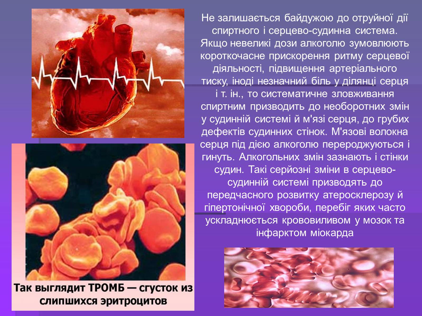 Презентація на тему «Алкоголізм» (варіант 2) - Слайд #9 Презентація на тему «Алкоголізм» (варіант 2) - Слайд #9