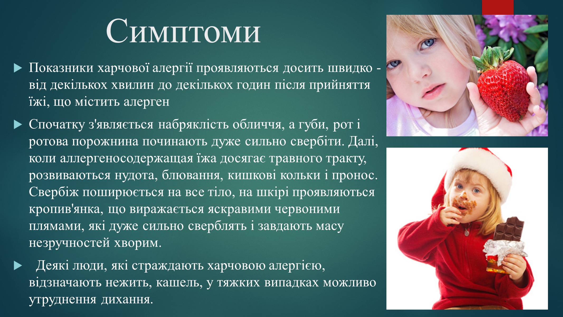 Презентація на тему «Харчова алергія» - Слайд #5 Презентація на тему «Харчова алергія» - Слайд #5
