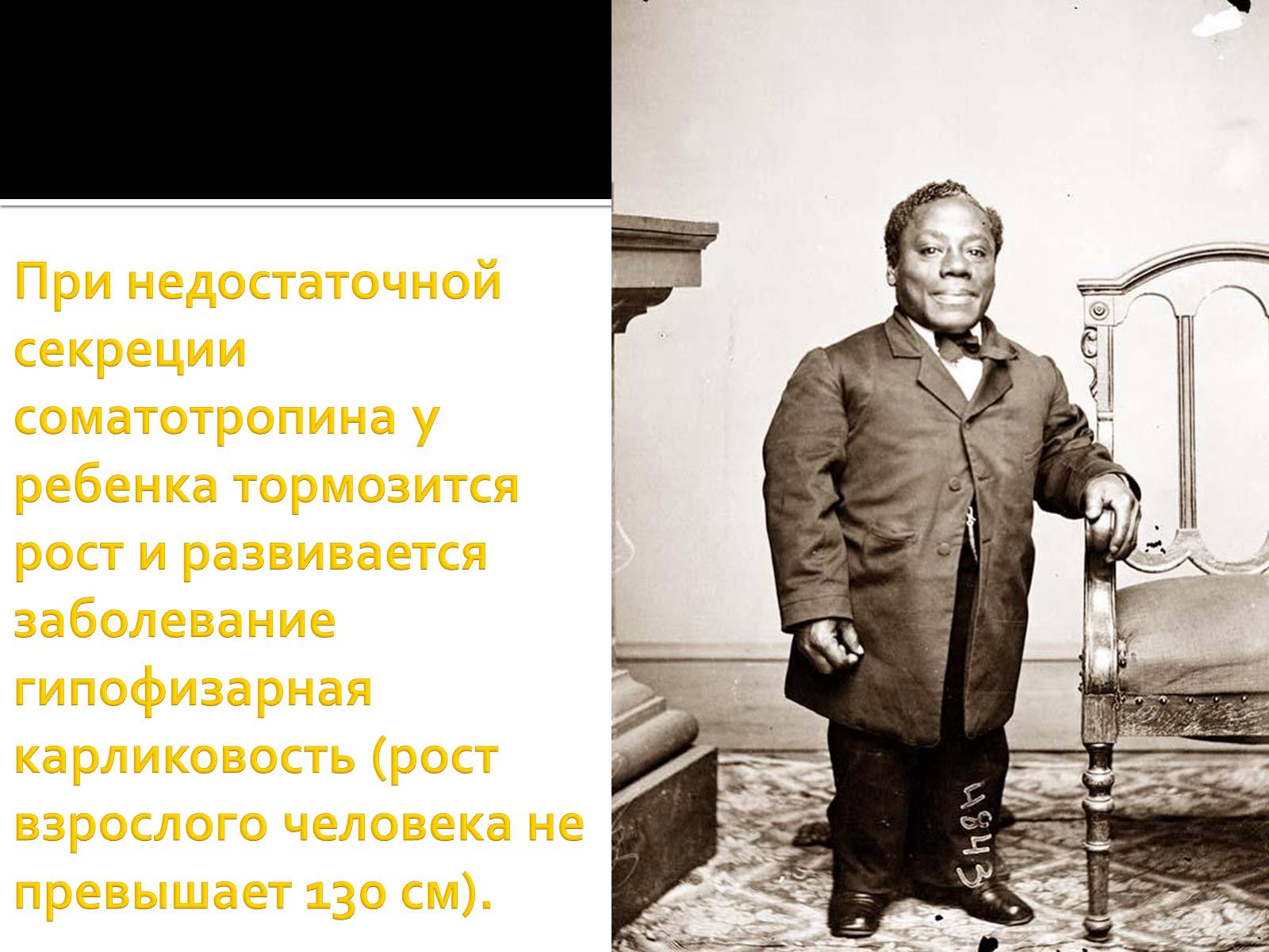 Презентація на тему «Железы внутренней секреции» (варіант 1) - Слайд #16 Презентація на тему «Железы внутренней секреции» (варіант 1) - Слайд #16