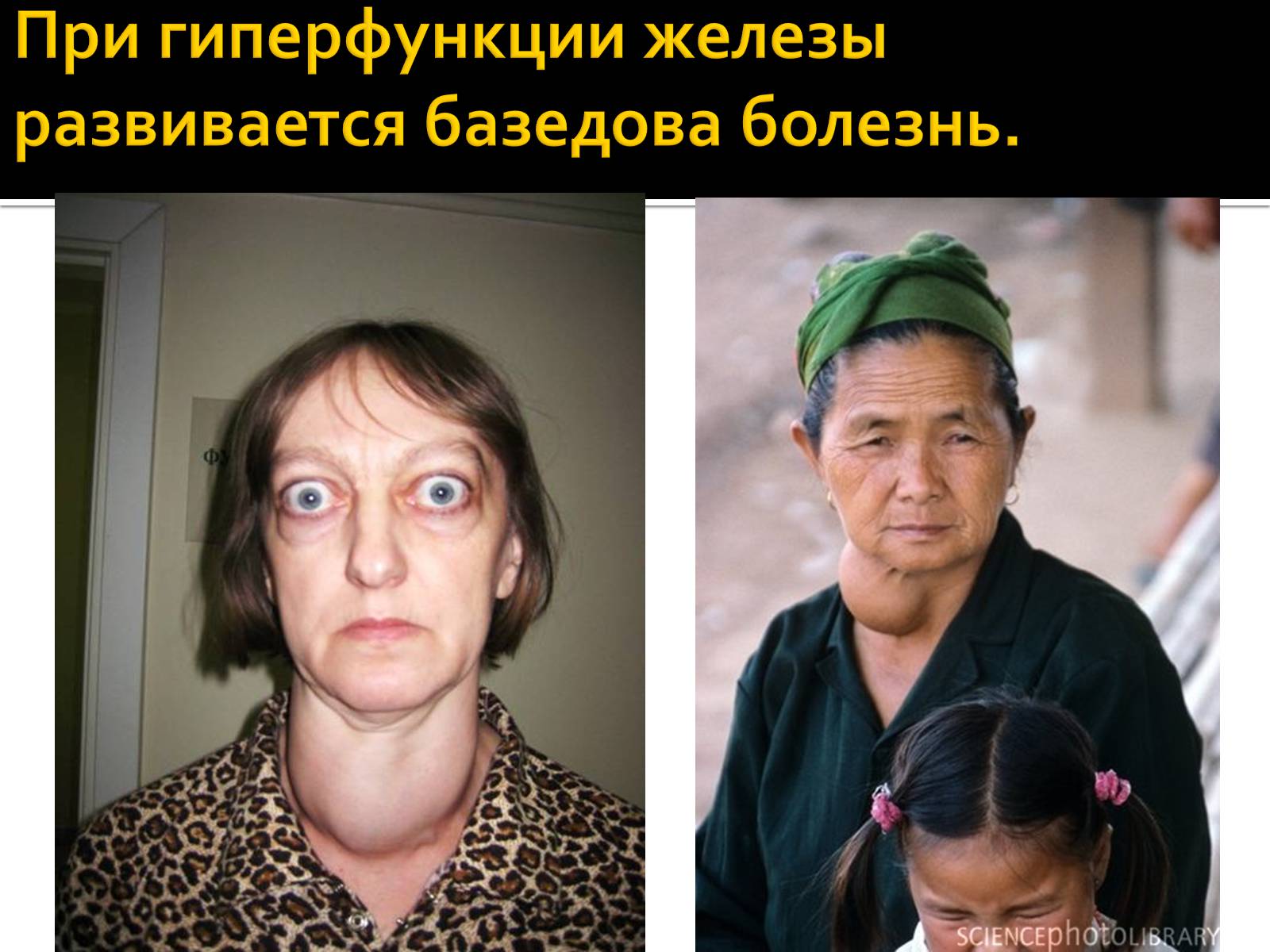 Презентація на тему «Железы внутренней секреции» (варіант 1) - Слайд #6 Презентація на тему «Железы внутренней секреции» (варіант 1) - Слайд #6