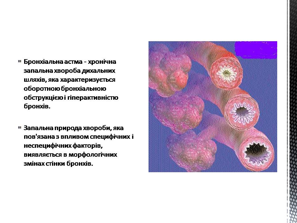 Презентація на тему «Астма» (варіант 2) - Слайд #2 Презентація на тему «Астма» (варіант 2) - Слайд #2