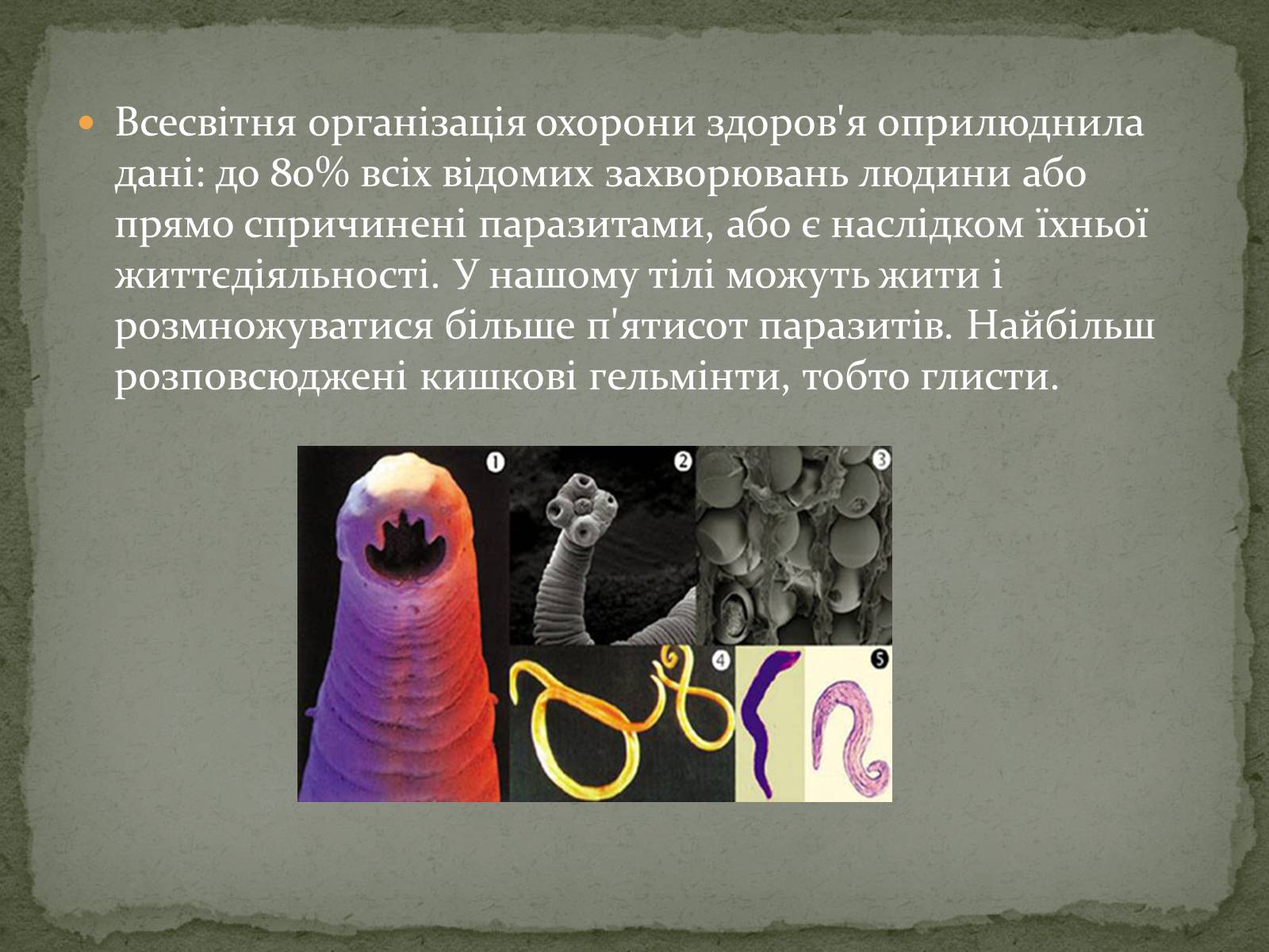 Презентація на тему «Глистяні захворювання» - Слайд #4 Презентація на тему «Глистяні захворювання» - Слайд #4