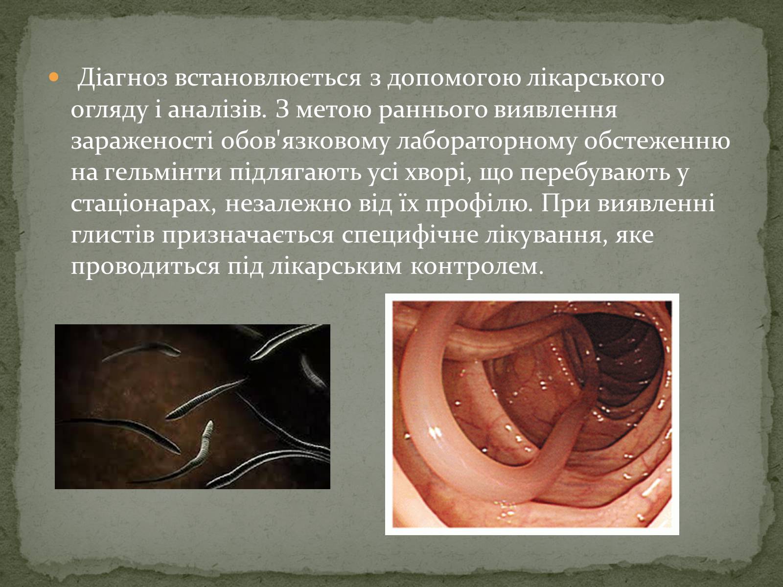 Презентація на тему «Глистяні захворювання» - Слайд #9 Презентація на тему «Глистяні захворювання» - Слайд #9