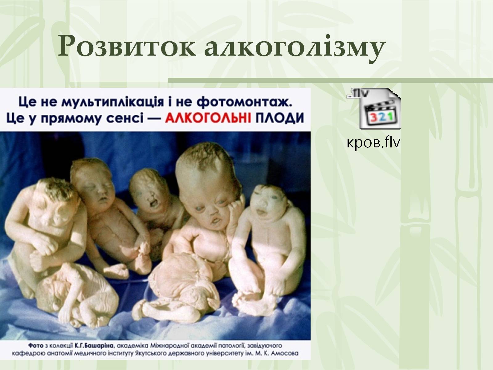 Презентація на тему «Як впливає на репродуктивне здоров’я алкоголь» - Слайд #17 Презентація на тему «Як впливає на репродуктивне здоров’я алкоголь» - Слайд #17