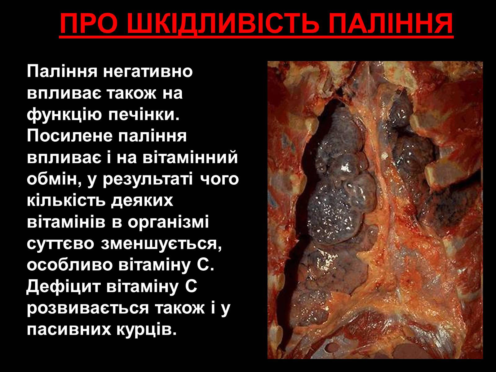 Презентація на тему «Тютюнопаління» (варіант 1) - Слайд #11 Презентація на тему «Тютюнопаління» (варіант 1) - Слайд #11