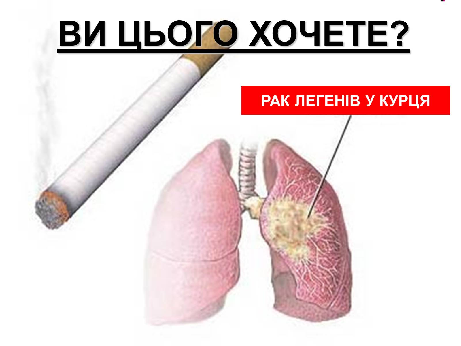 Презентація на тему «Тютюнопаління» (варіант 1) - Слайд #12 Презентація на тему «Тютюнопаління» (варіант 1) - Слайд #12