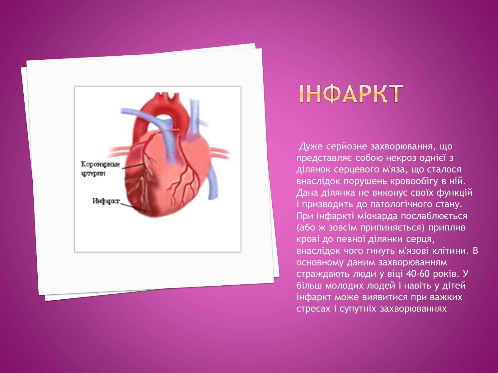 Презентація на тему «Догляд за хворими після інфаркту» - Слайд #2 Презентація на тему «Догляд за хворими після інфаркту» - Слайд #2