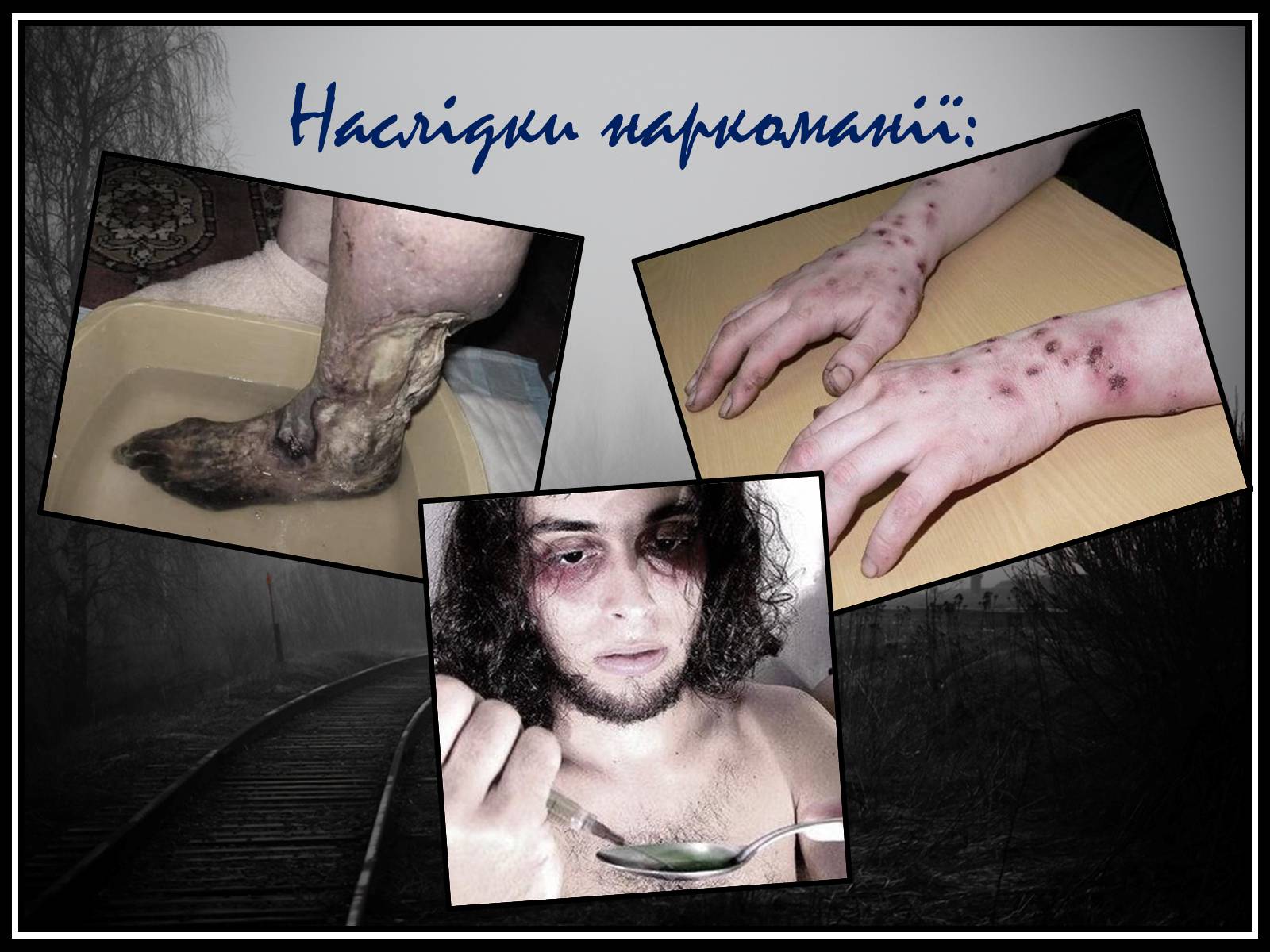 Презентація на тему «Шкідливий вплив наркотичних речовин на організм людини» (варіант 1) - Слайд #16 Презентація на тему «Шкідливий вплив наркотичних речовин на організм людини» (варіант 1) - Слайд #16