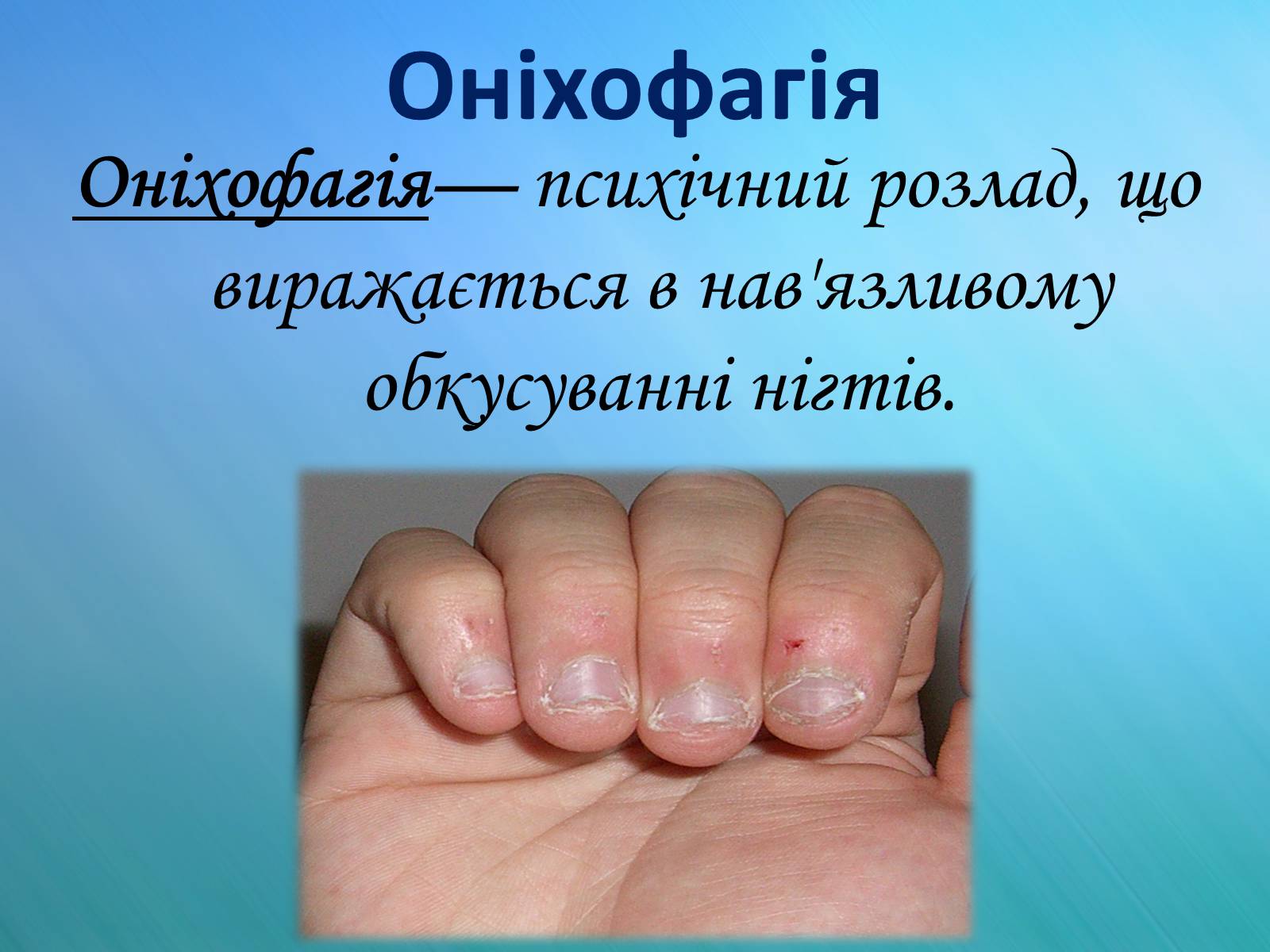 Презентація на тему «Психічні захворювання» - Слайд #30 Презентація на тему «Психічні захворювання» - Слайд #30