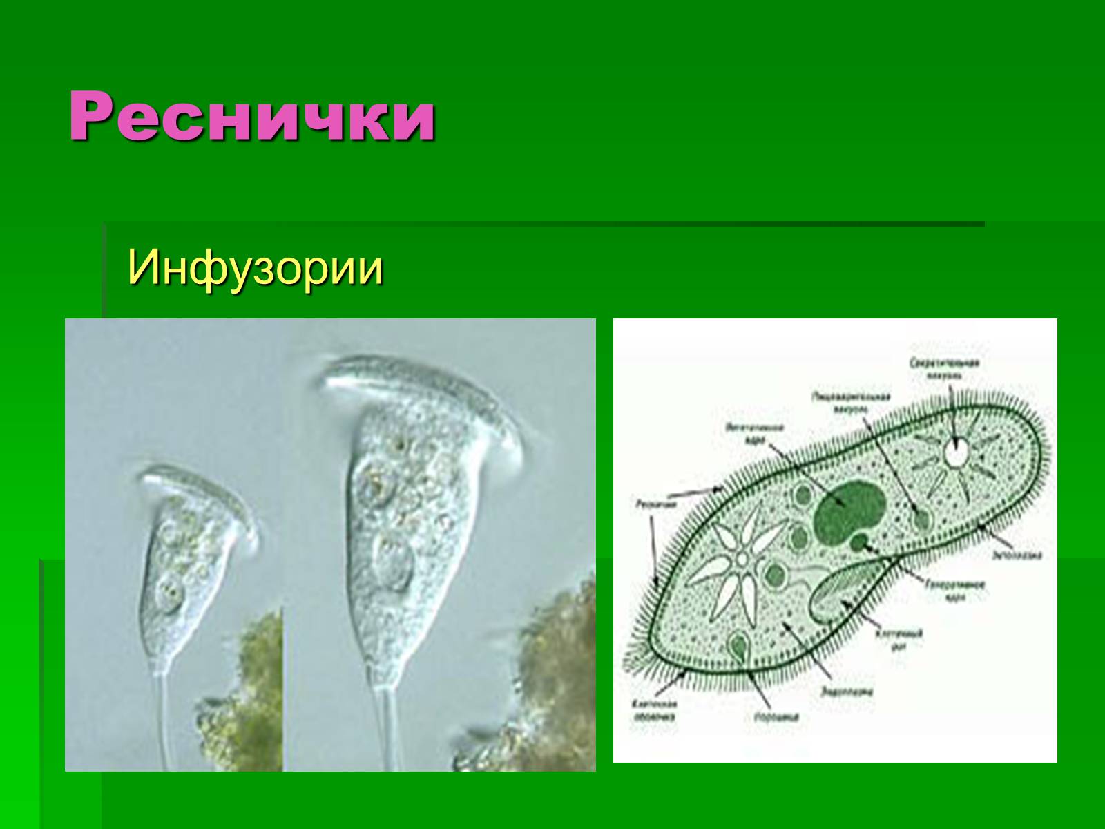 Презентація на тему «Подцарство Одноклеточные или Простейшие» - Слайд #11 Презентація на тему «Подцарство Одноклеточные или Простейшие» - Слайд #11