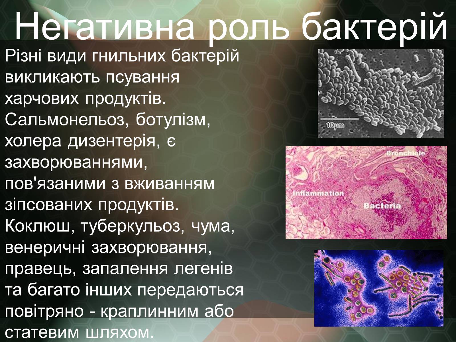 Презентація на тему «Прокаріотична клітина» - Слайд #19 Презентація на тему «Прокаріотична клітина» - Слайд #19