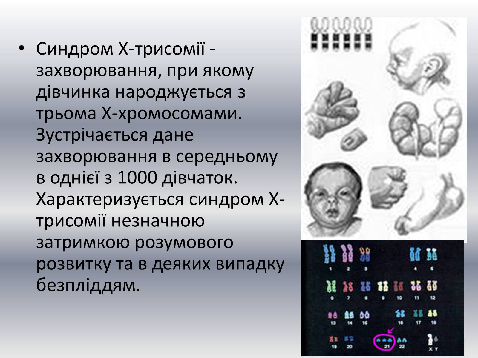 Презентація на тему «Хвороби клітини» - Слайд #11 Презентація на тему «Хвороби клітини» - Слайд #11