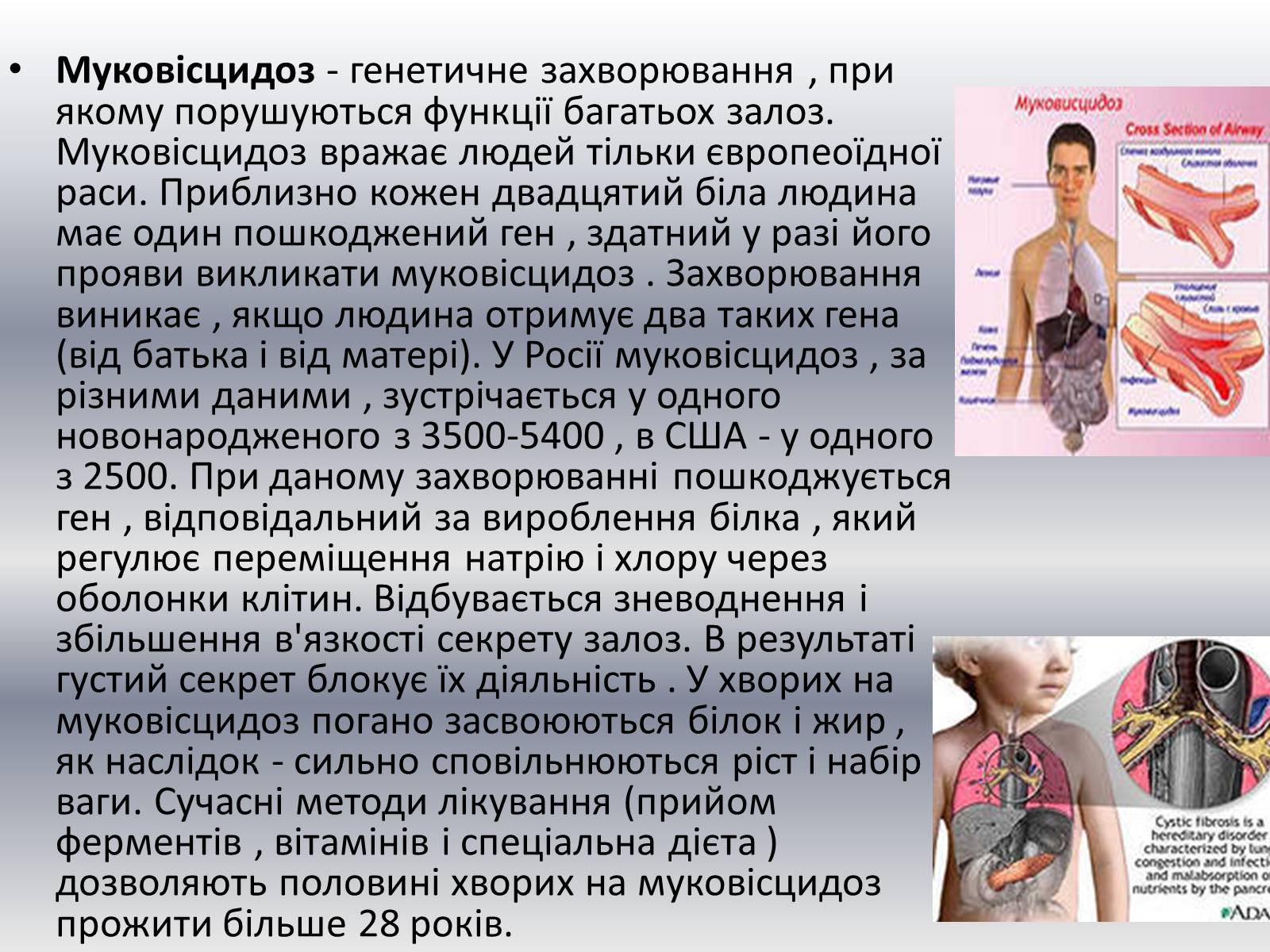 Презентація на тему «Хвороби клітини» - Слайд #13 Презентація на тему «Хвороби клітини» - Слайд #13