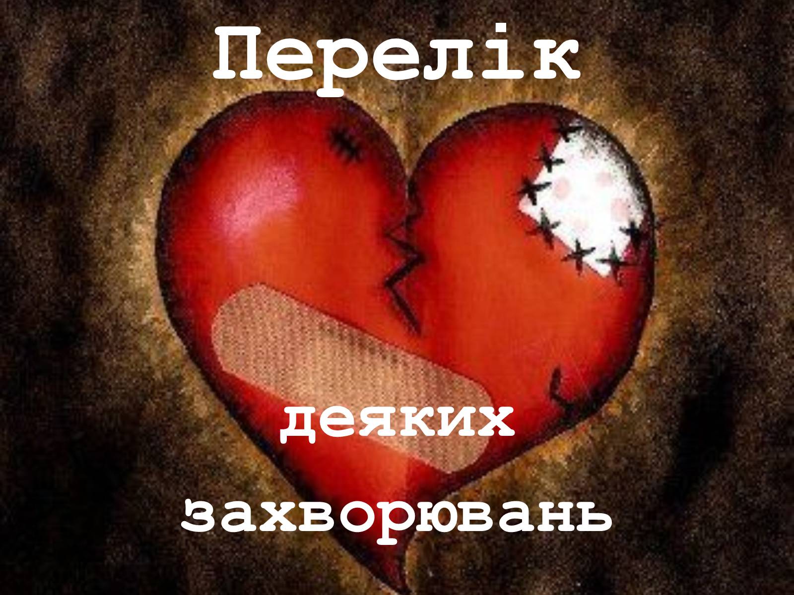 Презентація на тему «Захворювання серцево-судинної системи» (варіант 2) - Слайд #4 Презентація на тему «Захворювання серцево-судинної системи» (варіант 2) - Слайд #4