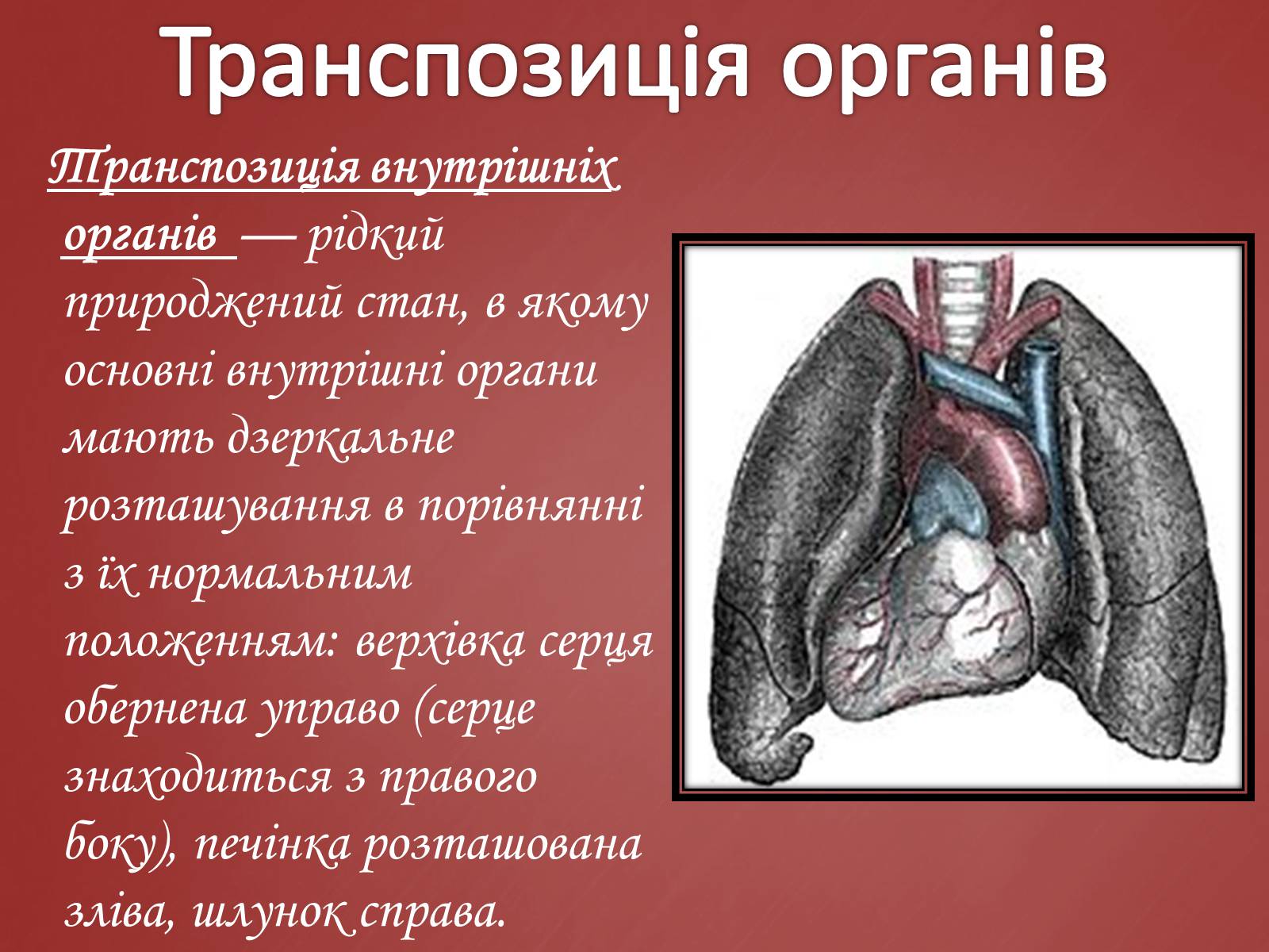 Презентація на тему «Захворювання серцево-судинної системи» (варіант 2) - Слайд #6 Презентація на тему «Захворювання серцево-судинної системи» (варіант 2) - Слайд #6