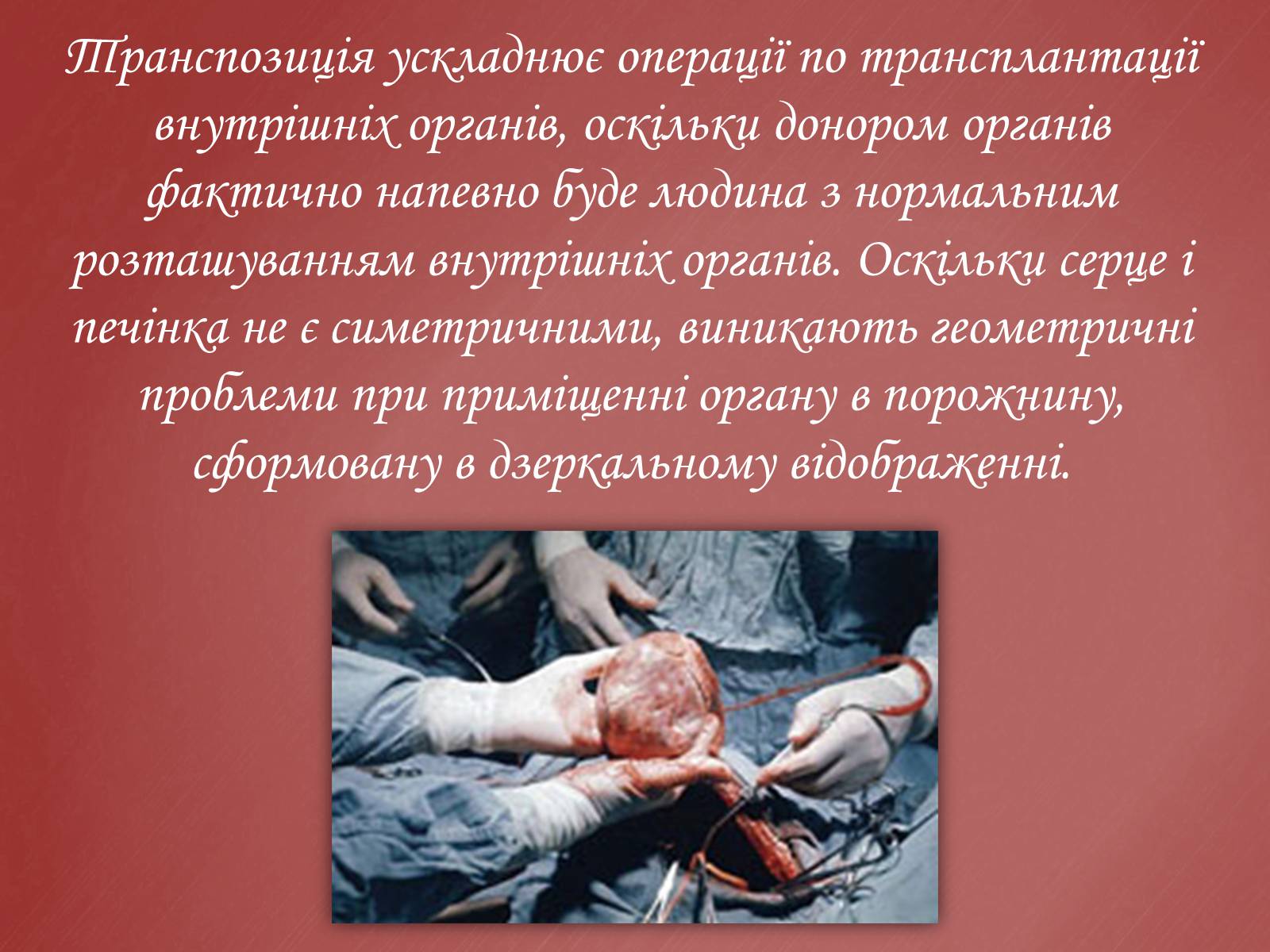 Презентація на тему «Захворювання серцево-судинної системи» (варіант 2) - Слайд #7 Презентація на тему «Захворювання серцево-судинної системи» (варіант 2) - Слайд #7