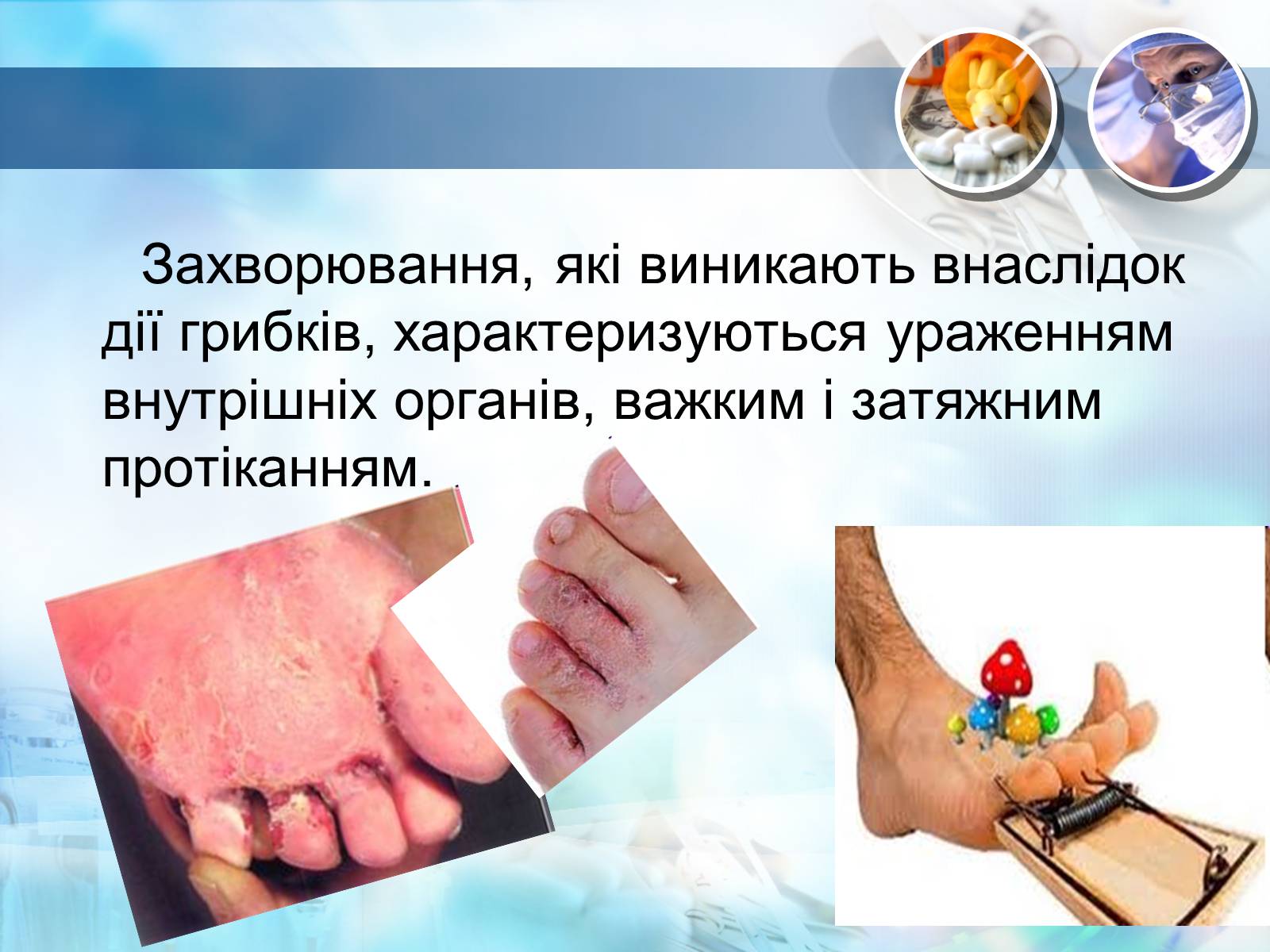 Презентація на тему «Біологічна зброя» - Слайд #13 Презентація на тему «Біологічна зброя» - Слайд #13