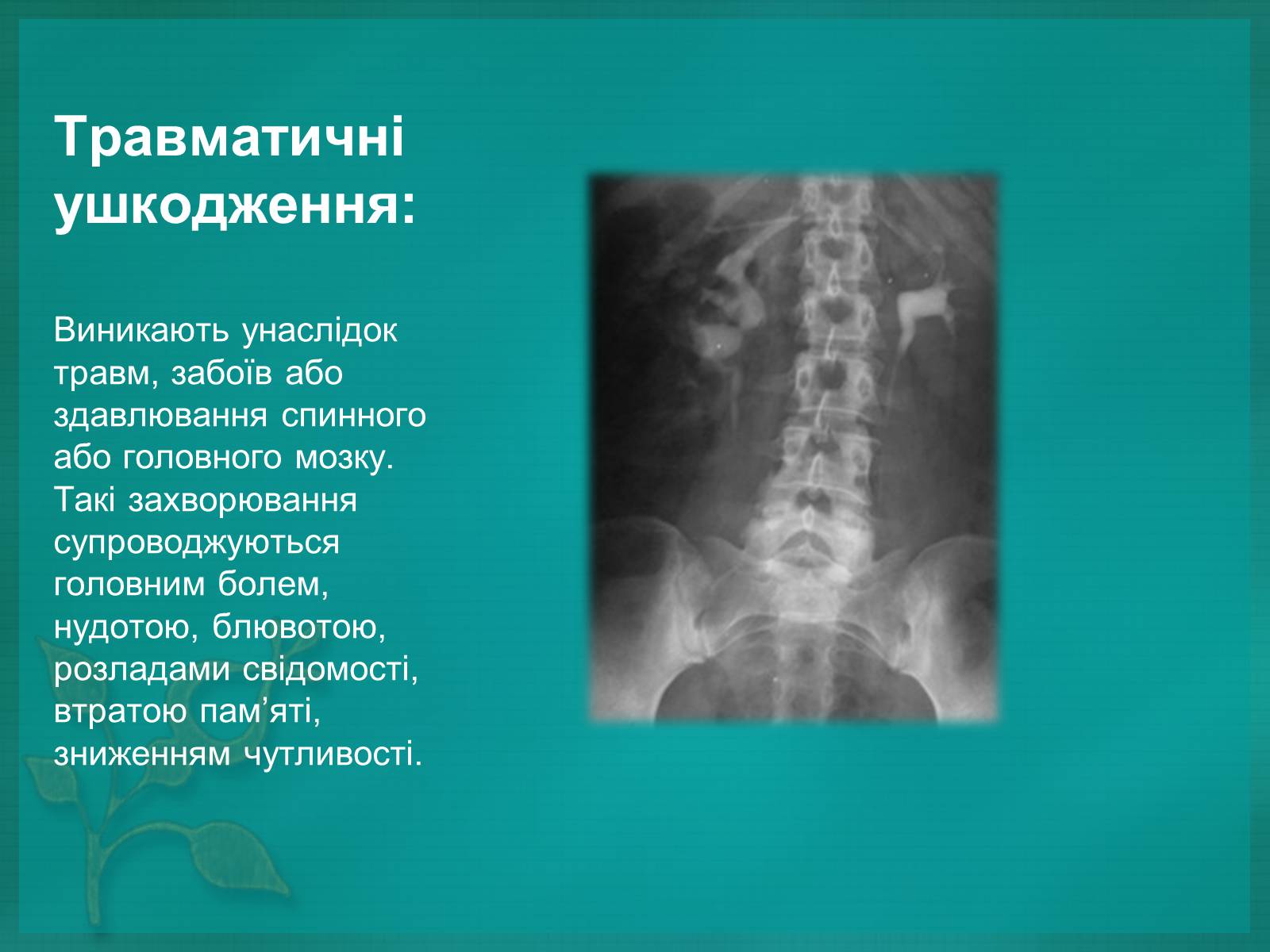 Презентація на тему «Хвороби нервової системи» (варіант 2) - Слайд #6