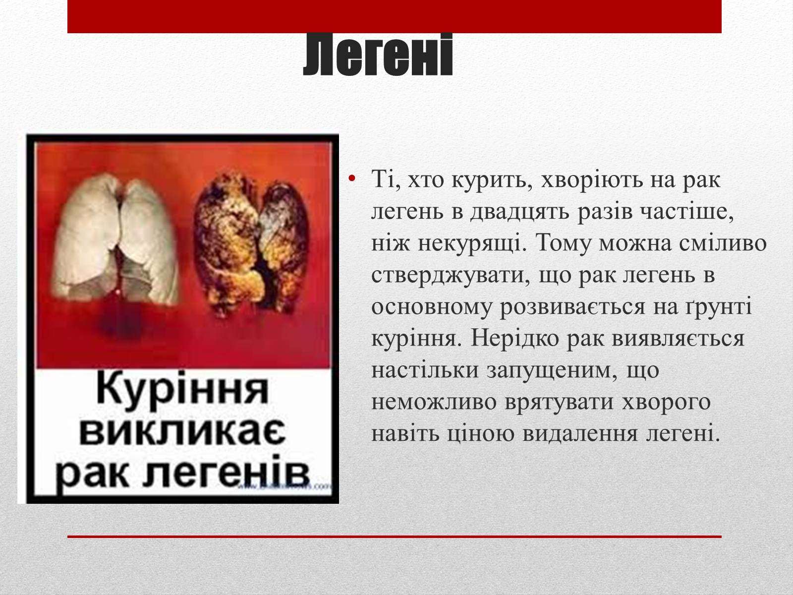 Презентація на тему «Вплив тютюну на людину» - Слайд #3 Презентація на тему «Вплив тютюну на людину» - Слайд #3