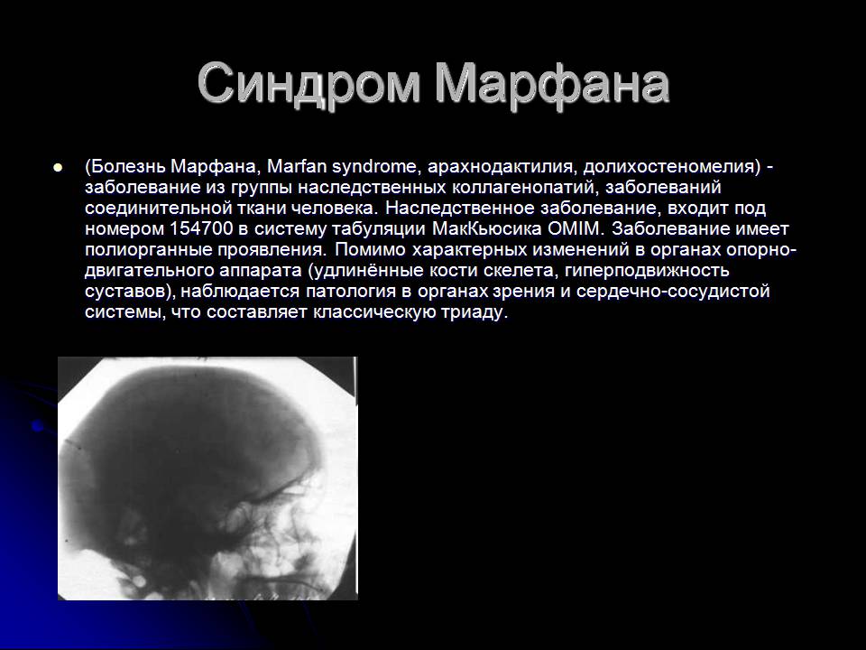 Презентація на тему «Генетика человека» (варіант 3) - Слайд #13 Презентація на тему «Генетика человека» (варіант 3) - Слайд #13