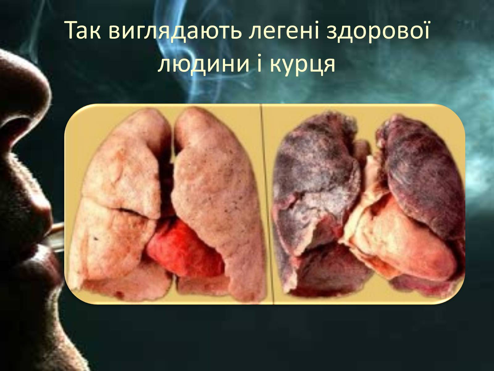 Презентація на тему «Куріння» (варіант 8) - Слайд #12 Презентація на тему «Куріння» (варіант 8) - Слайд #12