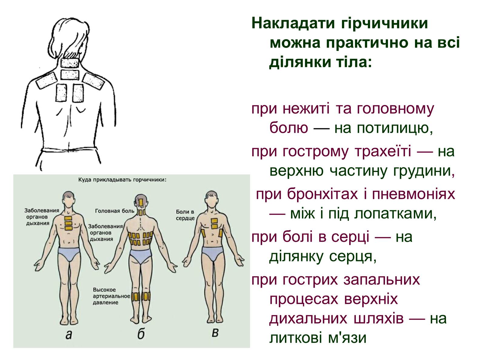Презентація на тему «Допоміжні засоби лікування» - Слайд #5 Презентація на тему «Допоміжні засоби лікування» - Слайд #5