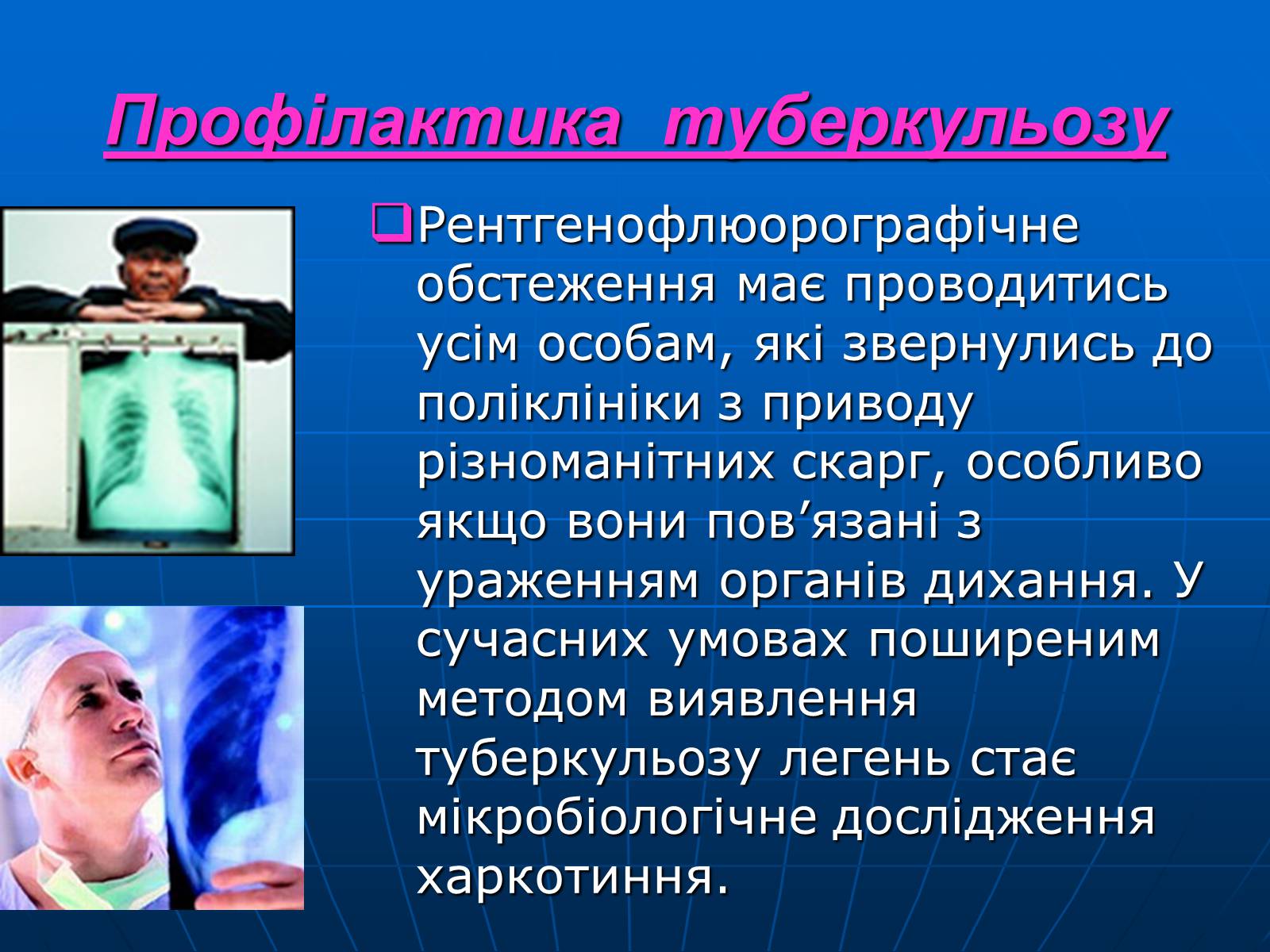Презентація на тему «Проблема туберкульозу в Україні» - Слайд #17 Презентація на тему «Проблема туберкульозу в Україні» - Слайд #17