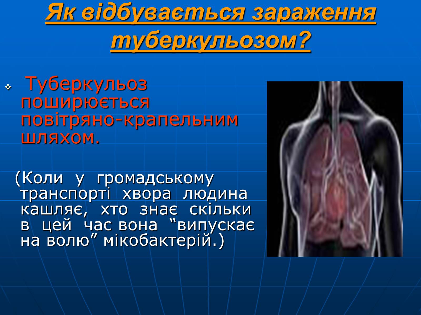 Презентація на тему «Проблема туберкульозу в Україні» - Слайд #5 Презентація на тему «Проблема туберкульозу в Україні» - Слайд #5