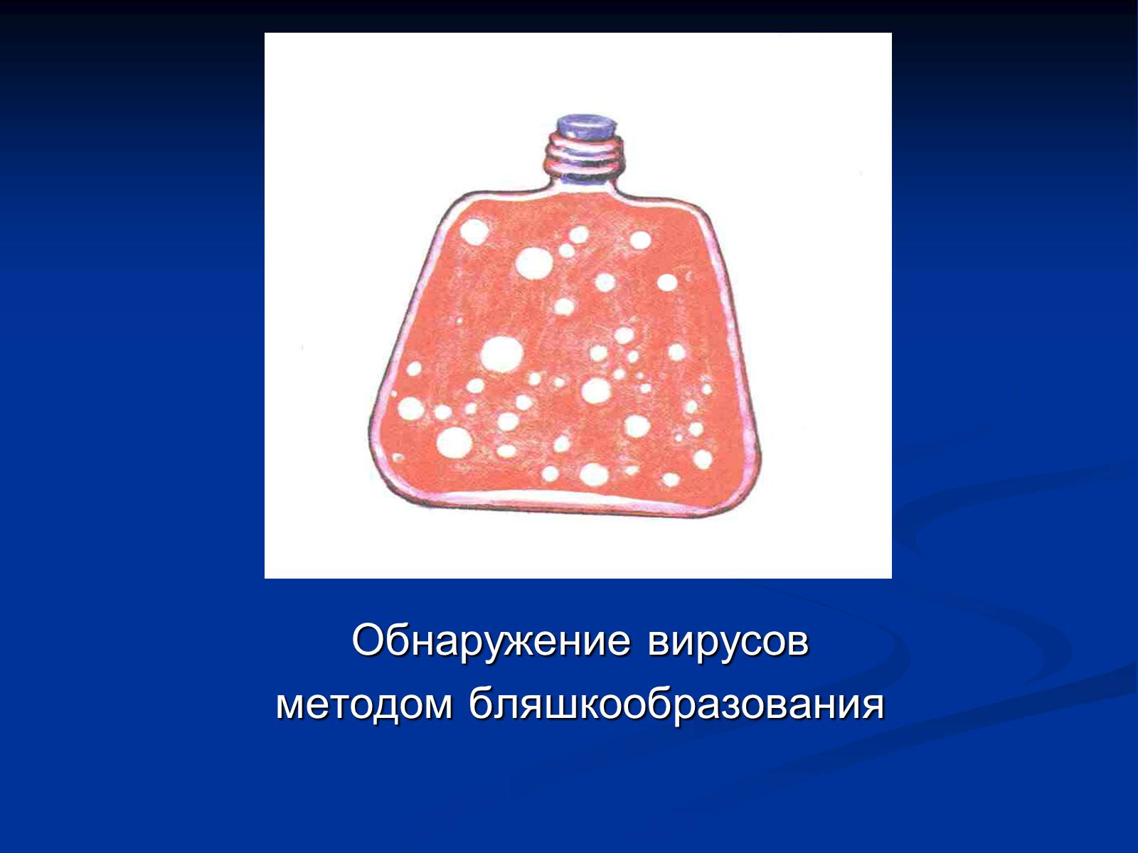 Презентація на тему «Вирусология» - Слайд #14 Презентація на тему «Вирусология» - Слайд #14