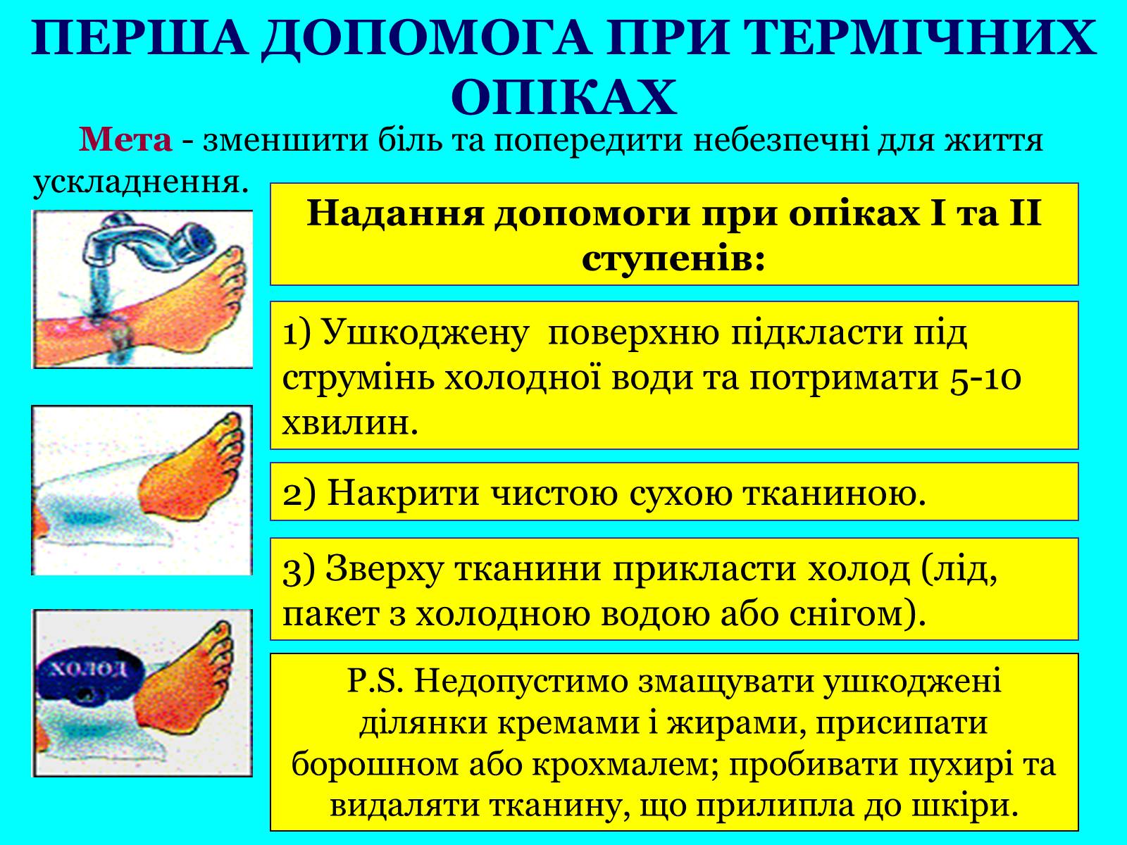 Презентація на тему «Опіки: види, причини, надання першої допомоги» - Слайд #11 Презентація на тему «Опіки: види, причини, надання першої допомоги» - Слайд #11