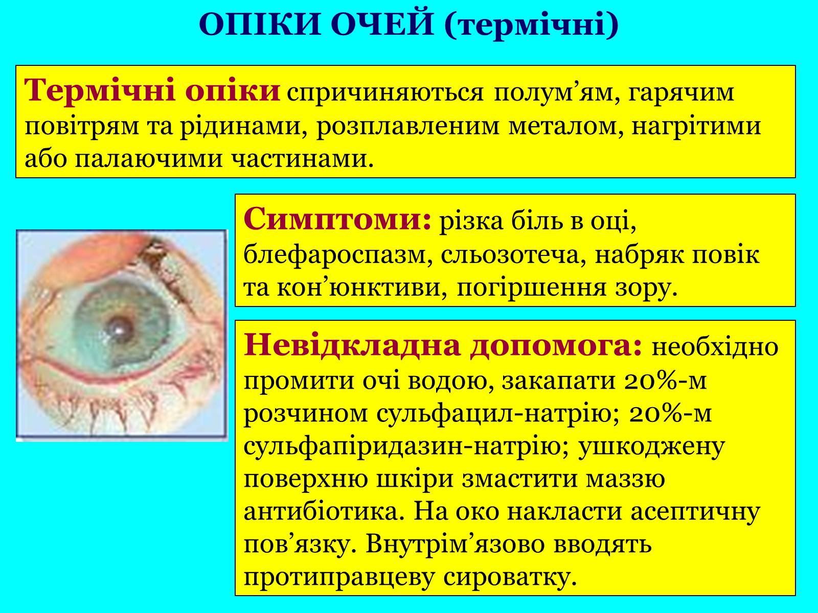 Презентація на тему «Опіки: види, причини, надання першої допомоги» - Слайд #18 Презентація на тему «Опіки: види, причини, надання першої допомоги» - Слайд #18
