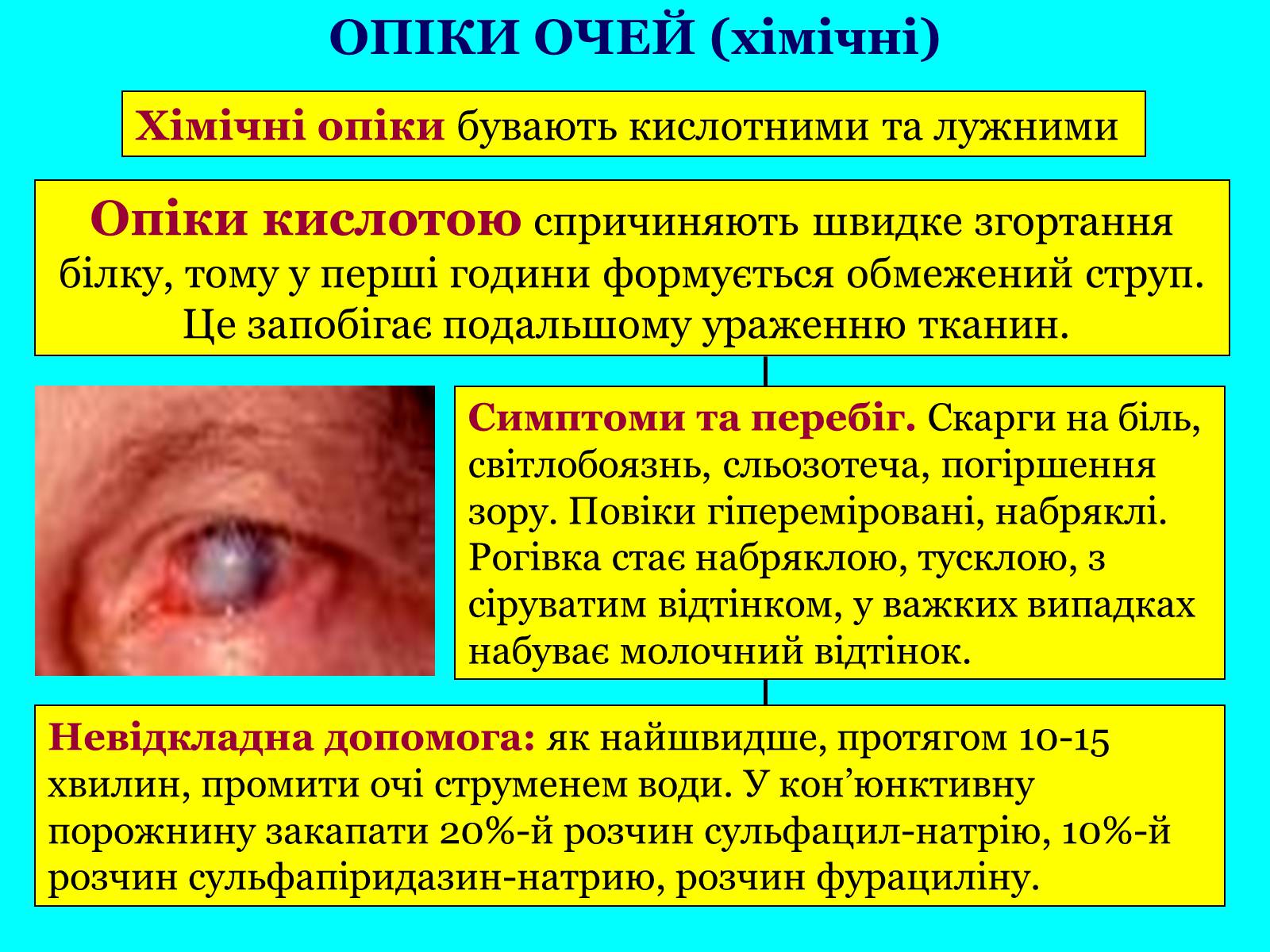 Презентація на тему «Опіки: види, причини, надання першої допомоги» - Слайд #19 Презентація на тему «Опіки: види, причини, надання першої допомоги» - Слайд #19