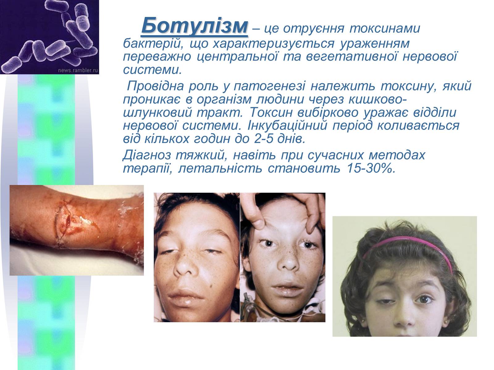 Презентація на тему «Інфекційні захворювання» (варіант 4) - Слайд #5 Презентація на тему «Інфекційні захворювання» (варіант 4) - Слайд #5