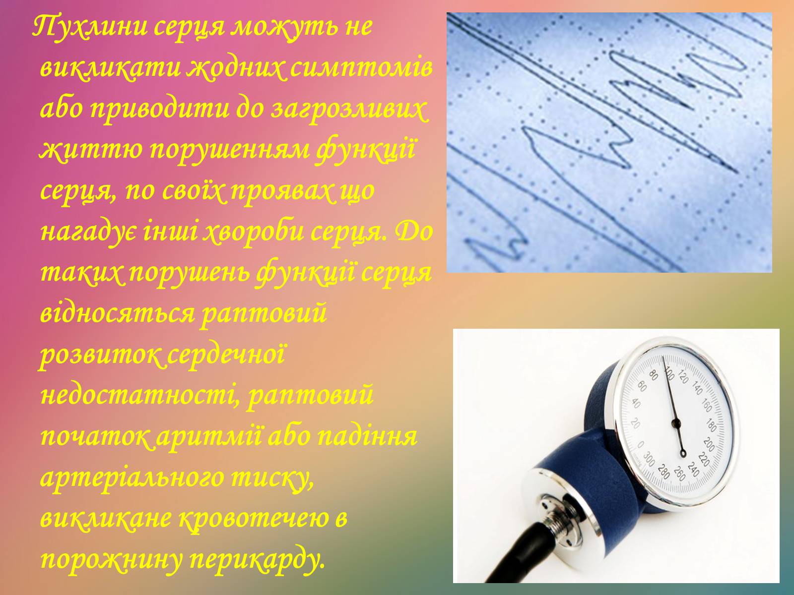 Презентація на тему «Захворювання органів кровообігу» - Слайд #21 Презентація на тему «Захворювання органів кровообігу» - Слайд #21