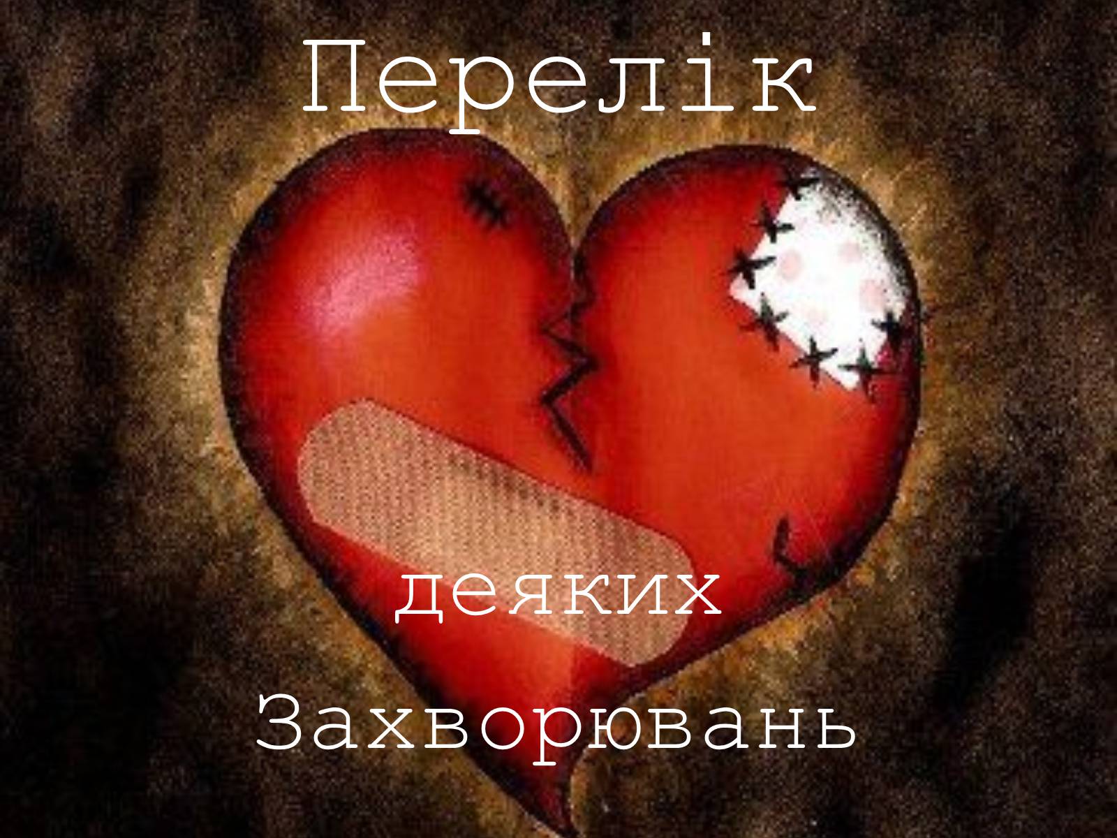 Презентація на тему «Захворювання органів кровообігу» - Слайд #7 Презентація на тему «Захворювання органів кровообігу» - Слайд #7