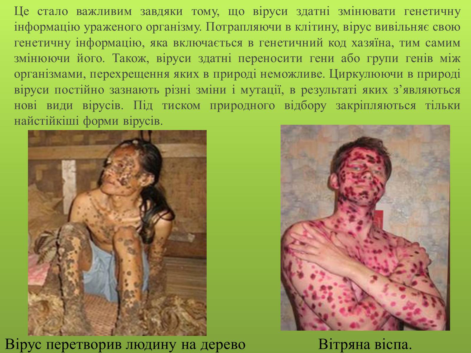Презентація на тему «Роль вірусів в житті людини» - Слайд #5 Презентація на тему «Роль вірусів в житті людини» - Слайд #5