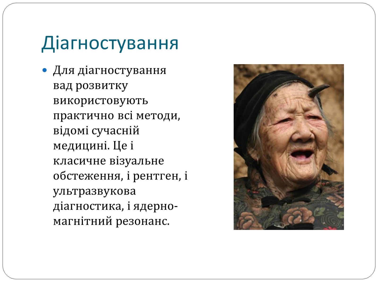 Презентація на тему «Діагностування вад розвитку людини» (варіант 1) - Слайд #8 Презентація на тему «Діагностування вад розвитку людини» (варіант 1) - Слайд #8