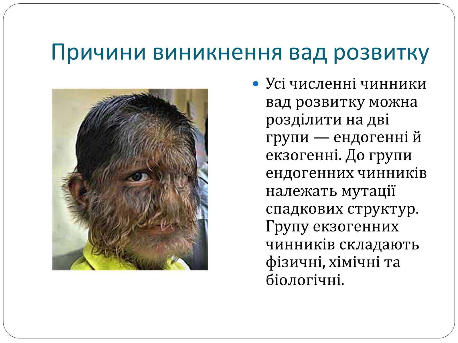 Презентація на тему «Діагностування вад розвитку людини» (варіант 1) - Слайд #9 Презентація на тему «Діагностування вад розвитку людини» (варіант 1) - Слайд #9