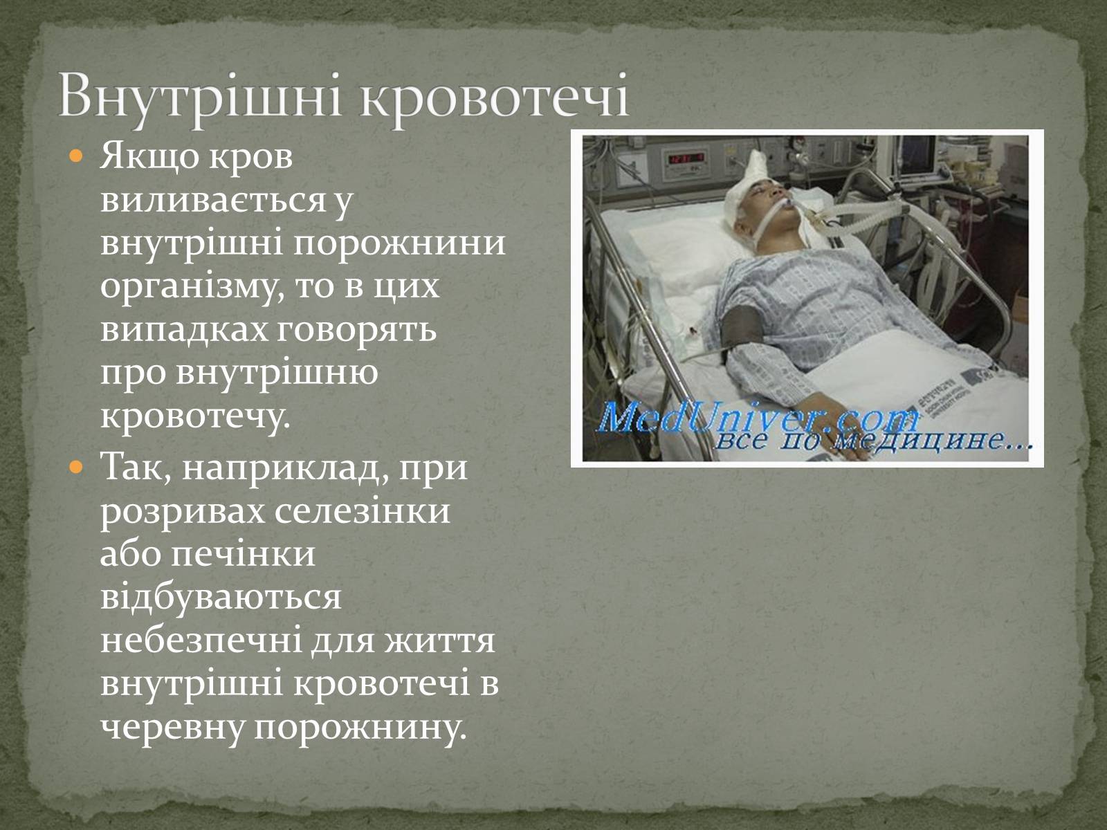 Презентація на тему «Види кровотеч» (варіант 1) - Слайд #11 Презентація на тему «Види кровотеч» (варіант 1) - Слайд #11