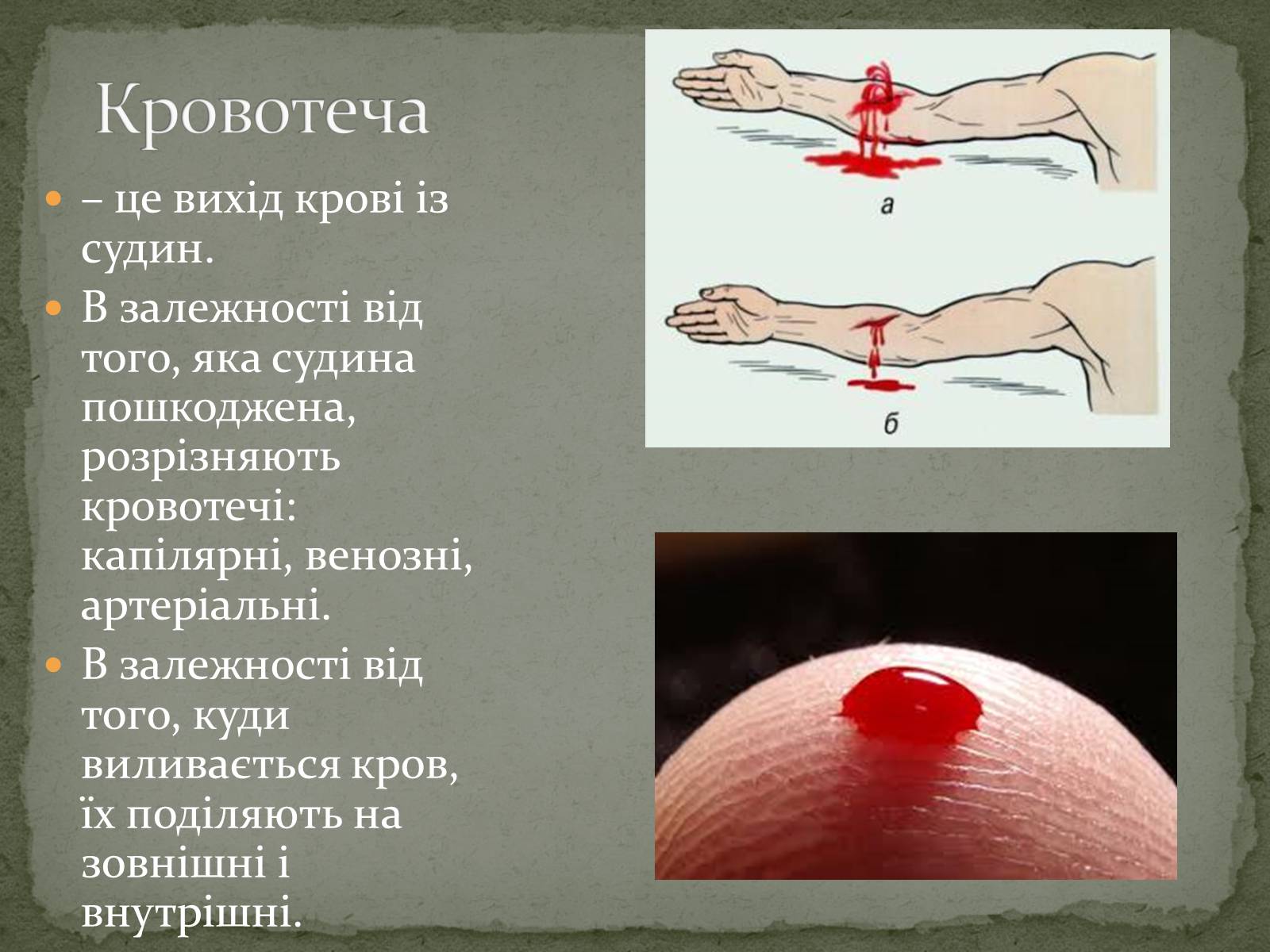 Презентація на тему «Види кровотеч» (варіант 1) - Слайд #2 Презентація на тему «Види кровотеч» (варіант 1) - Слайд #2