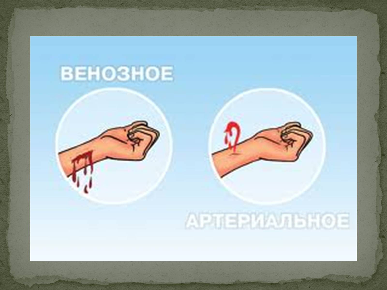 Презентація на тему «Види кровотеч» (варіант 1) - Слайд #3 Презентація на тему «Види кровотеч» (варіант 1) - Слайд #3