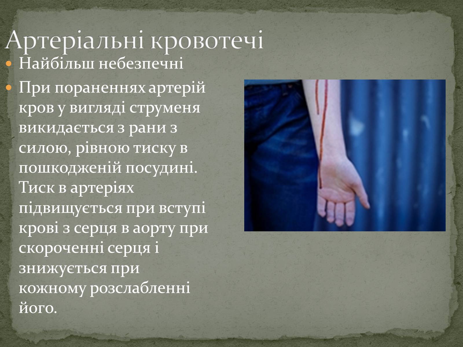 Презентація на тему «Види кровотеч» (варіант 1) - Слайд #4 Презентація на тему «Види кровотеч» (варіант 1) - Слайд #4