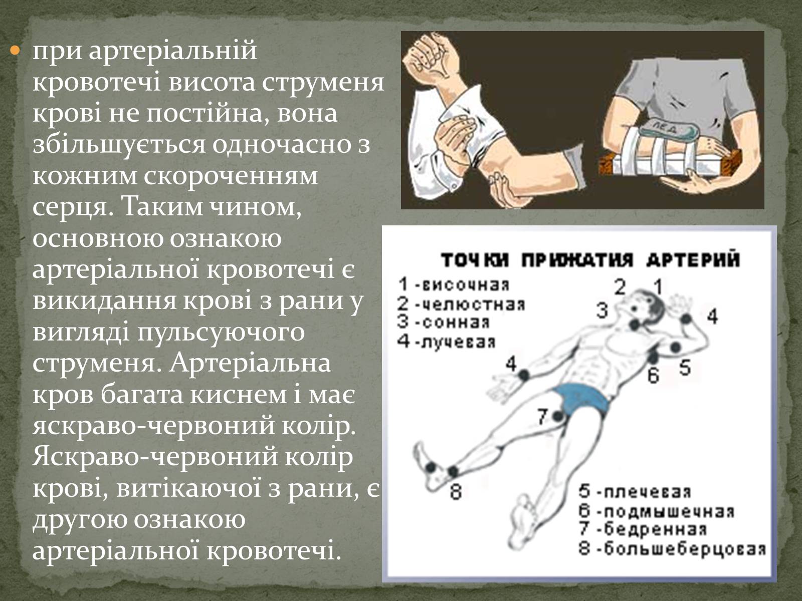 Презентація на тему «Види кровотеч» (варіант 1) - Слайд #5 Презентація на тему «Види кровотеч» (варіант 1) - Слайд #5