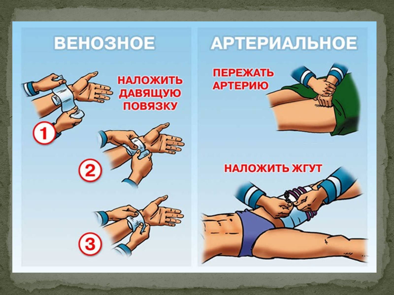 Презентація на тему «Види кровотеч» (варіант 1) - Слайд #8 Презентація на тему «Види кровотеч» (варіант 1) - Слайд #8