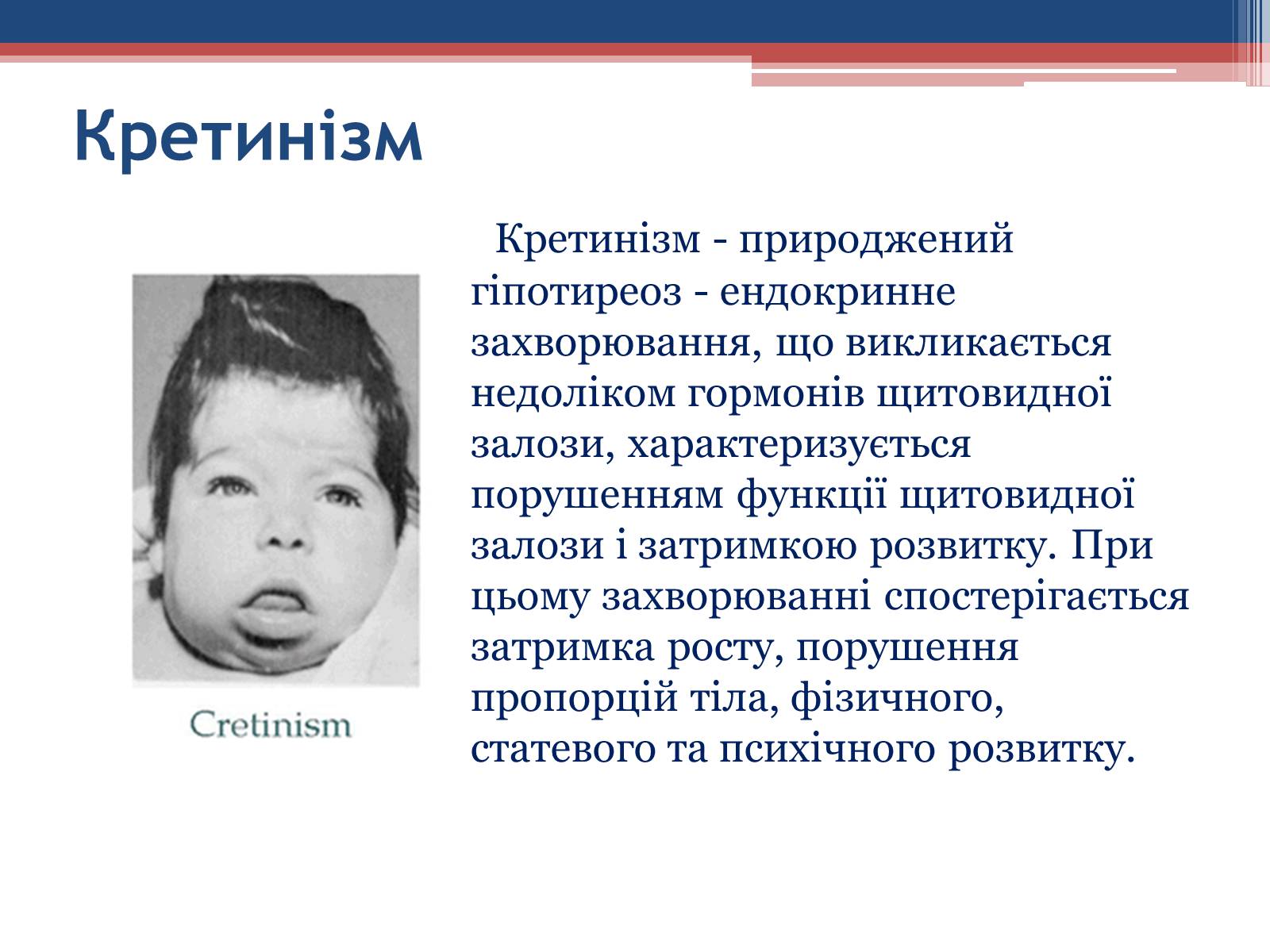 Презентація на тему «Порушення гормональних функцій ендокринних залоз» - Слайд #10 Презентація на тему «Порушення гормональних функцій ендокринних залоз» - Слайд #10